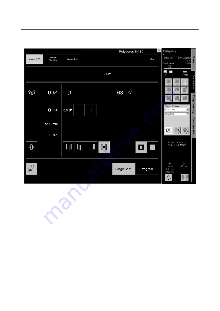 Siemens AXIOM Iconos R200 Operator'S Manual Download Page 140