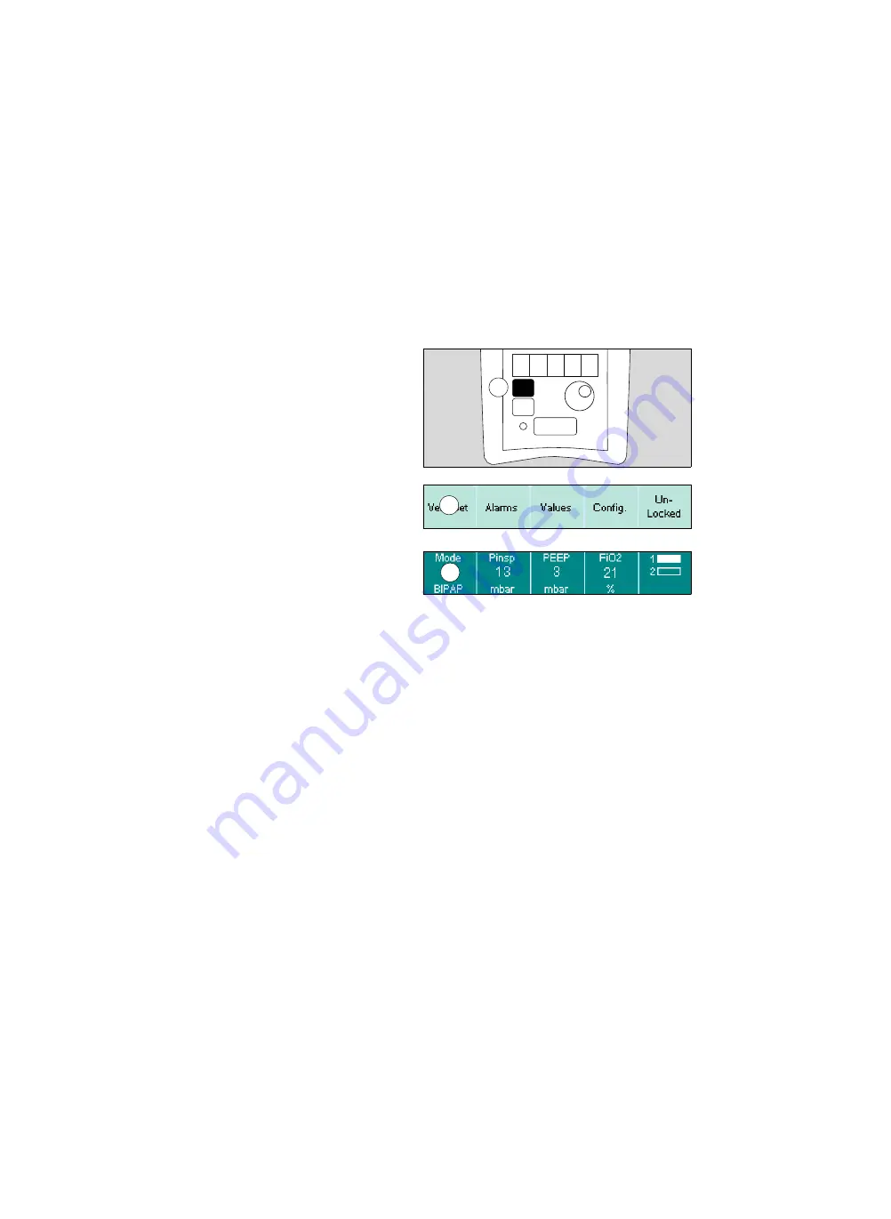 Siemens Drager medical Carina Instructions For Use Manual Download Page 62