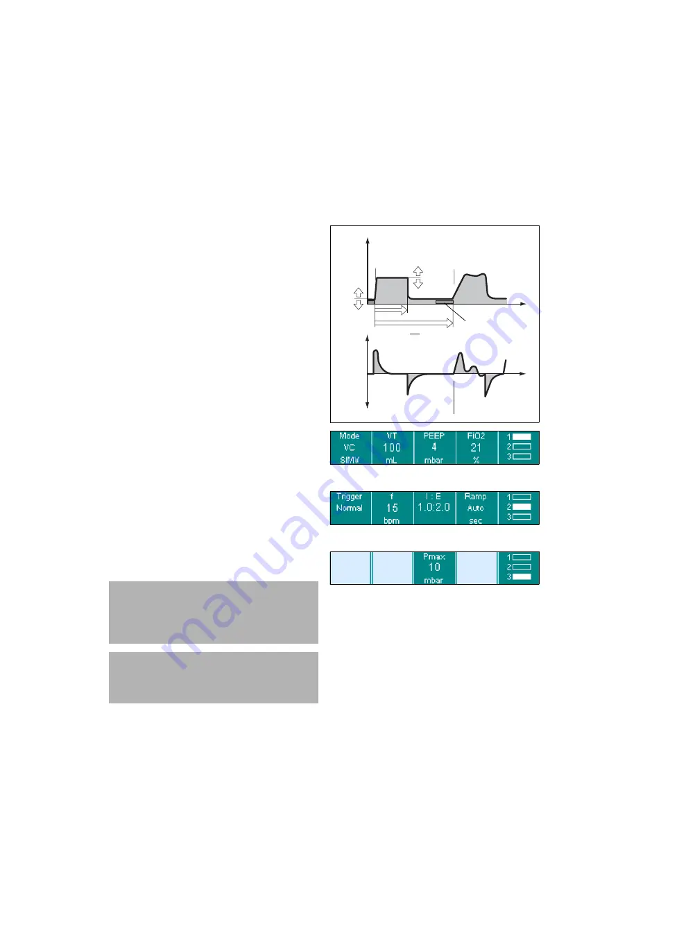 Siemens Drager medical Carina Instructions For Use Manual Download Page 64