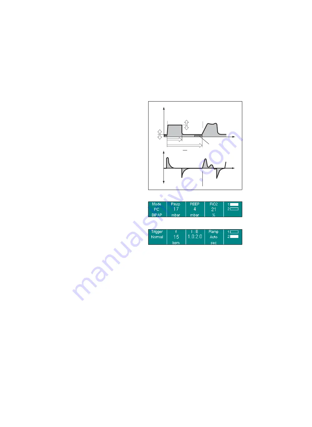 Siemens Drager medical Carina Instructions For Use Manual Download Page 66