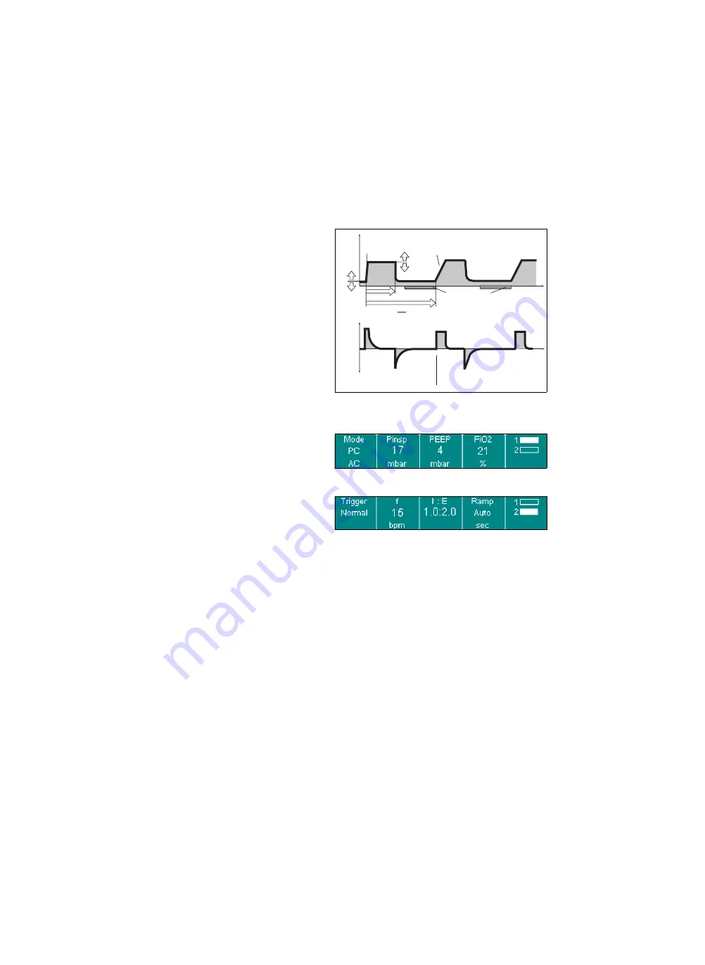 Siemens Drager medical Carina Instructions For Use Manual Download Page 68