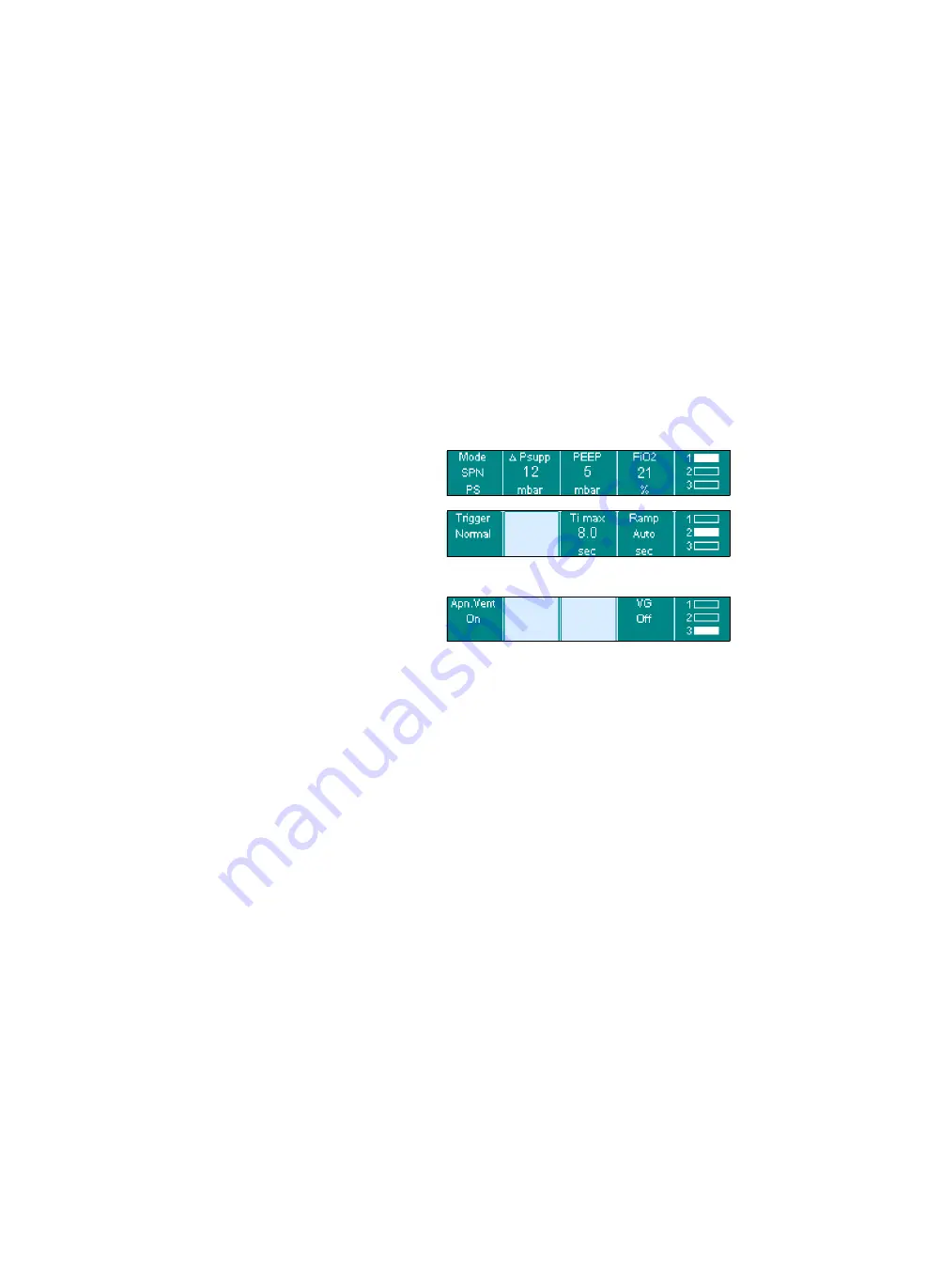 Siemens Drager medical Carina Instructions For Use Manual Download Page 70