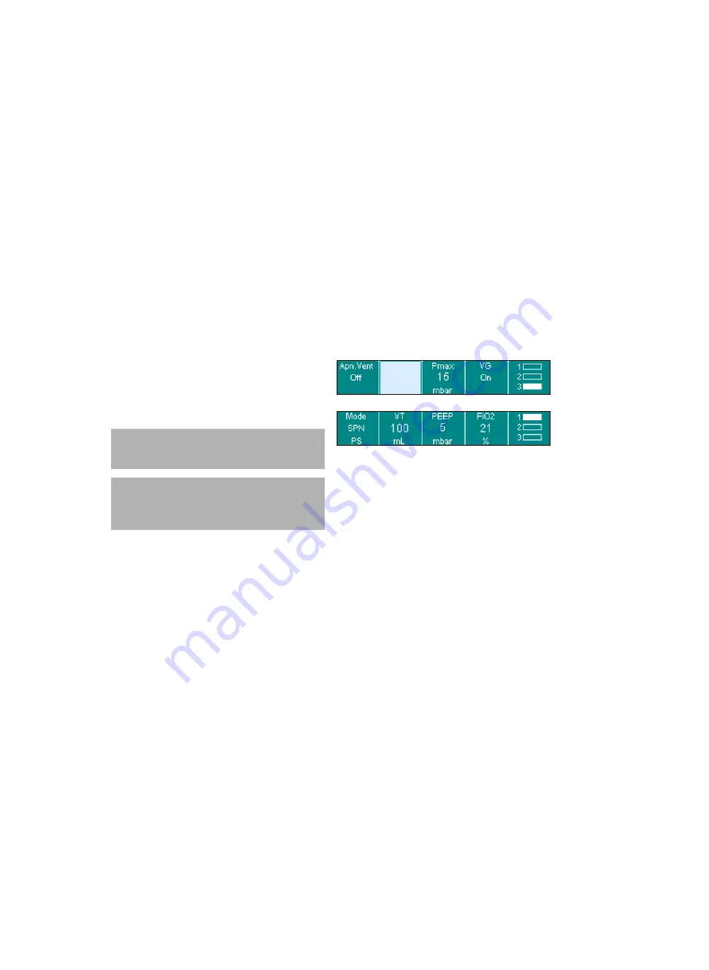 Siemens Drager medical Carina Instructions For Use Manual Download Page 74