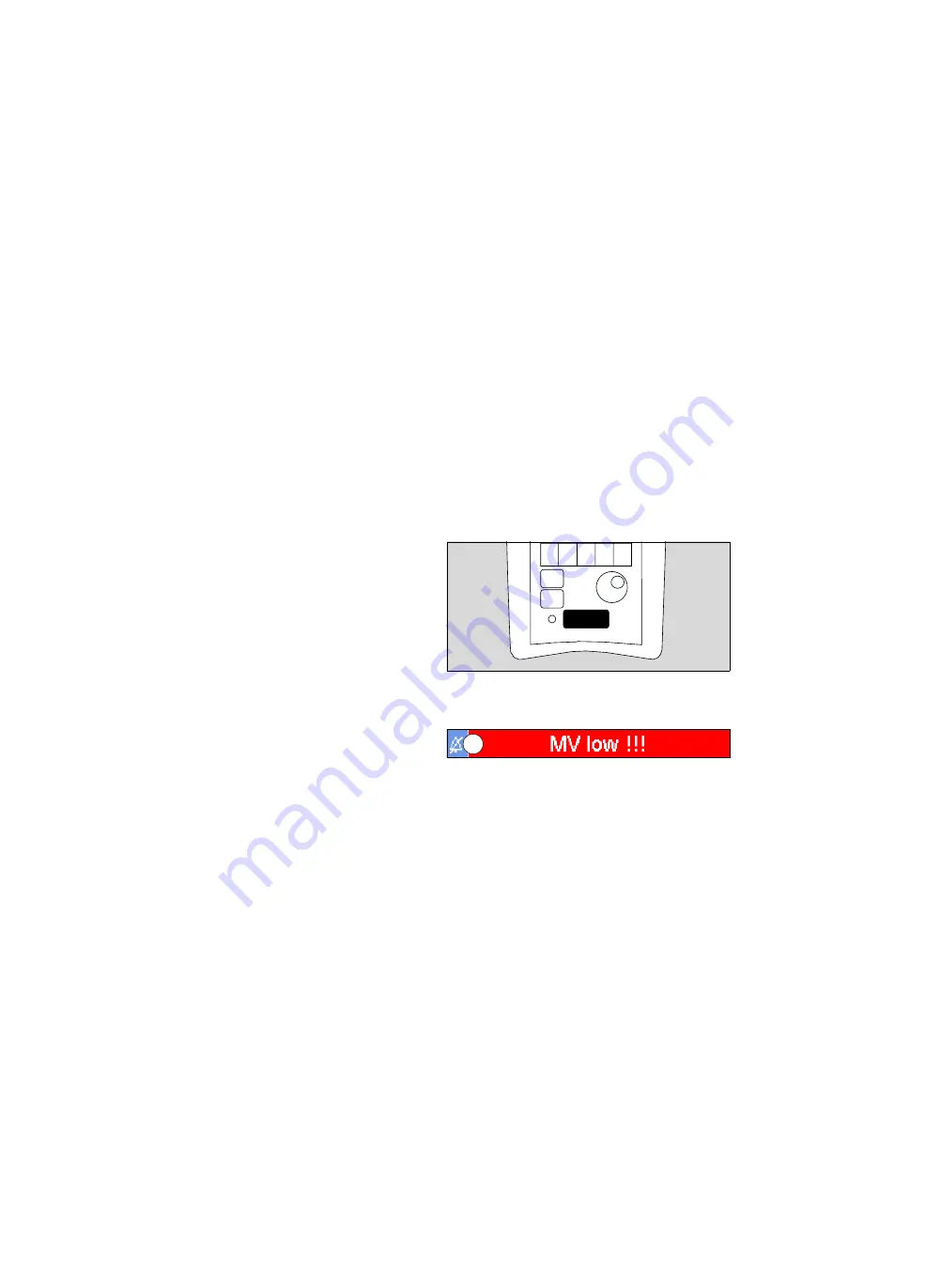 Siemens Drager medical Carina Instructions For Use Manual Download Page 86