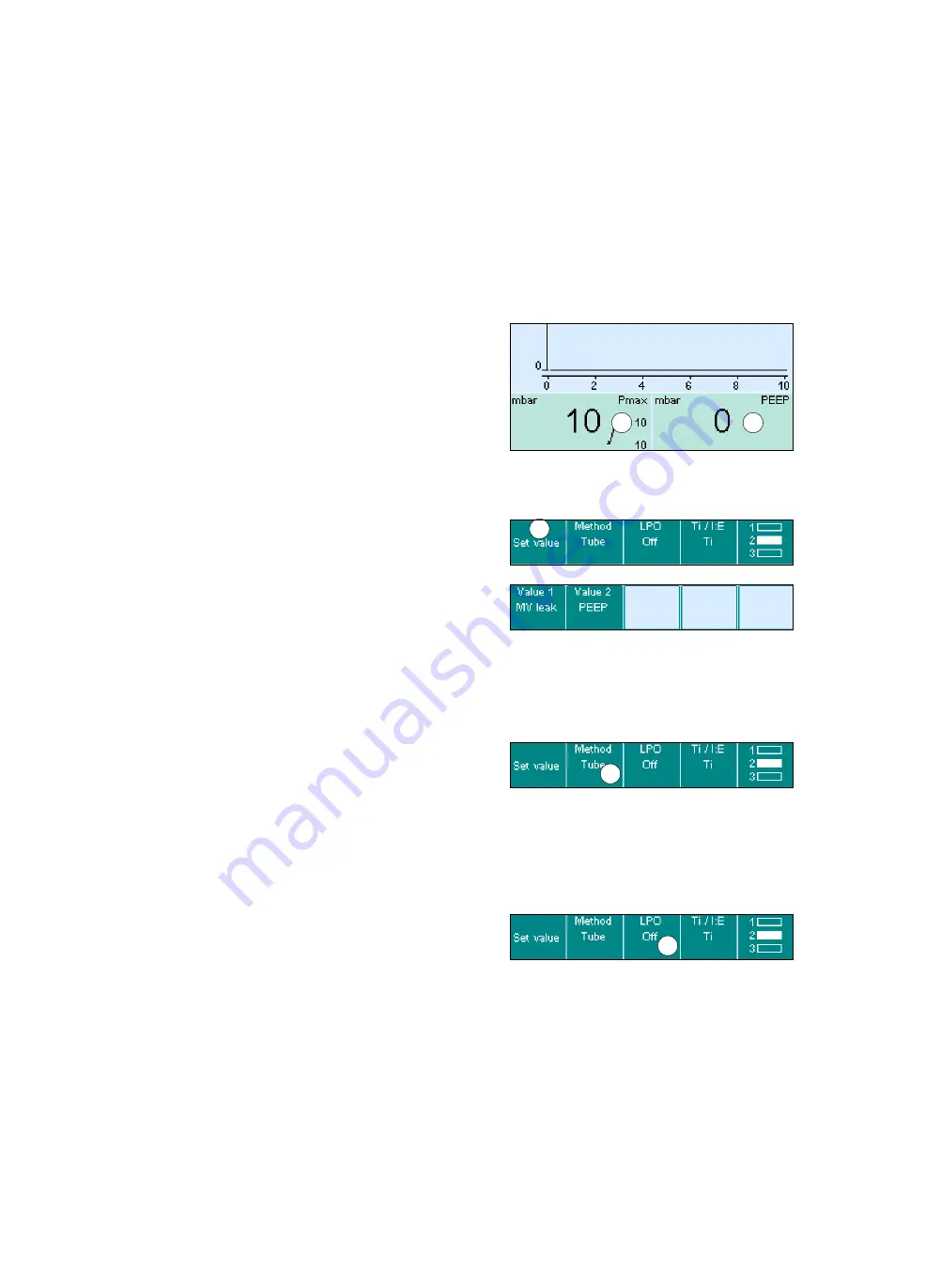 Siemens Drager medical Carina Instructions For Use Manual Download Page 93