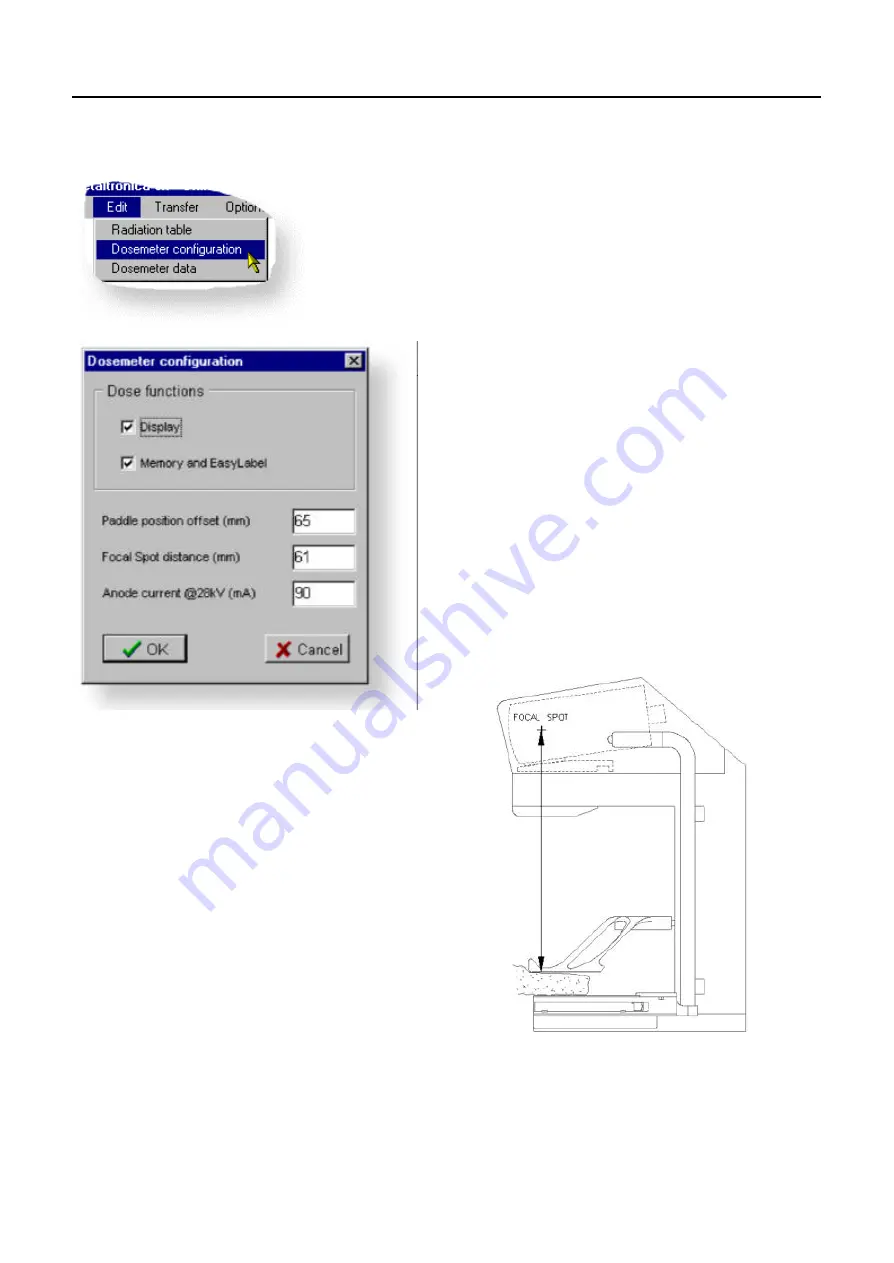 Siemens MAMMOMAT Balance Troubleshooting Manual Download Page 45