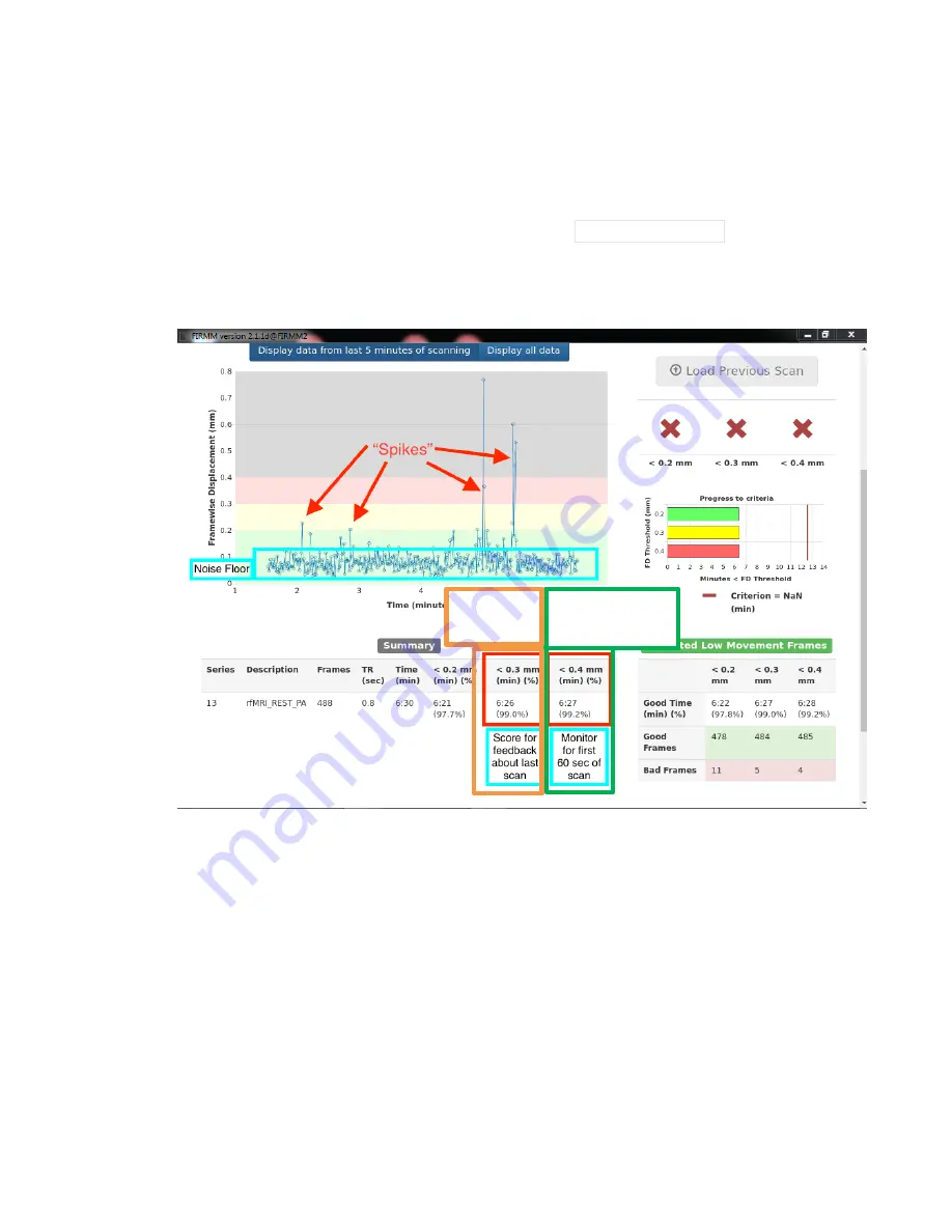 Siemens Prisma 3T User Manual Download Page 49