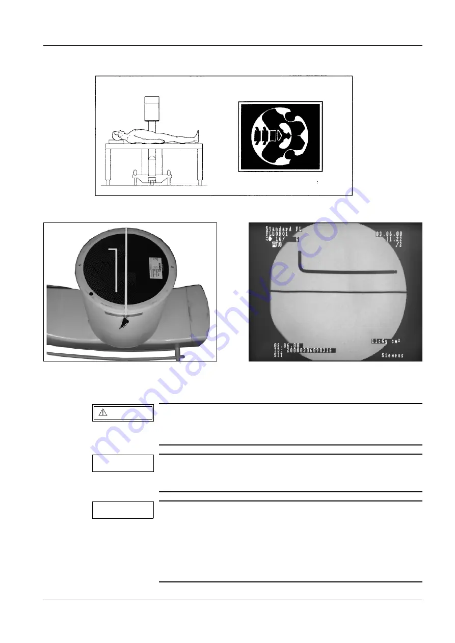 Siemens SIREMOBIL Iso-C Service Instructions Manual Download Page 55