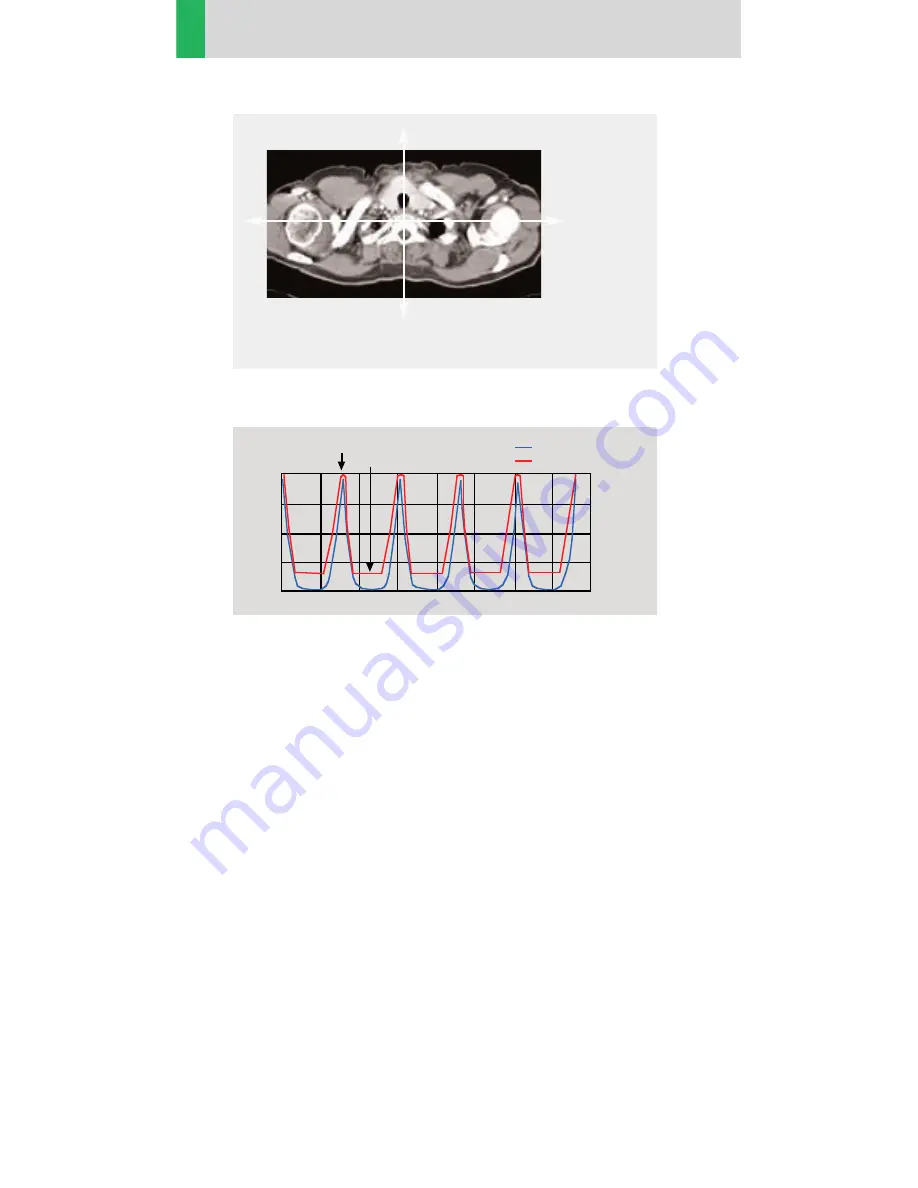 Siemens SOMATOM Emotion 6 Application Manual Download Page 18