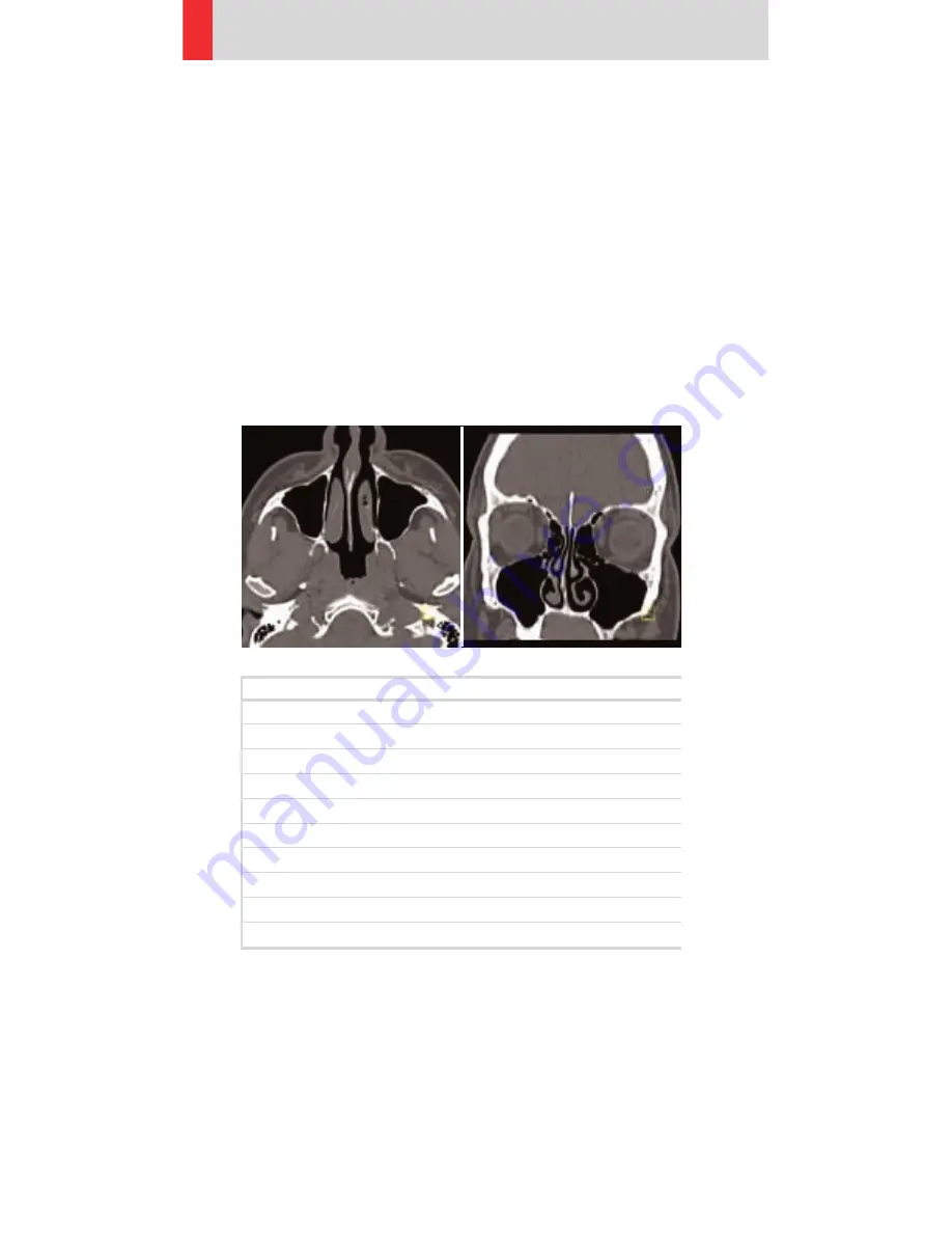 Siemens SOMATOM Emotion 6 Application Manual Download Page 90