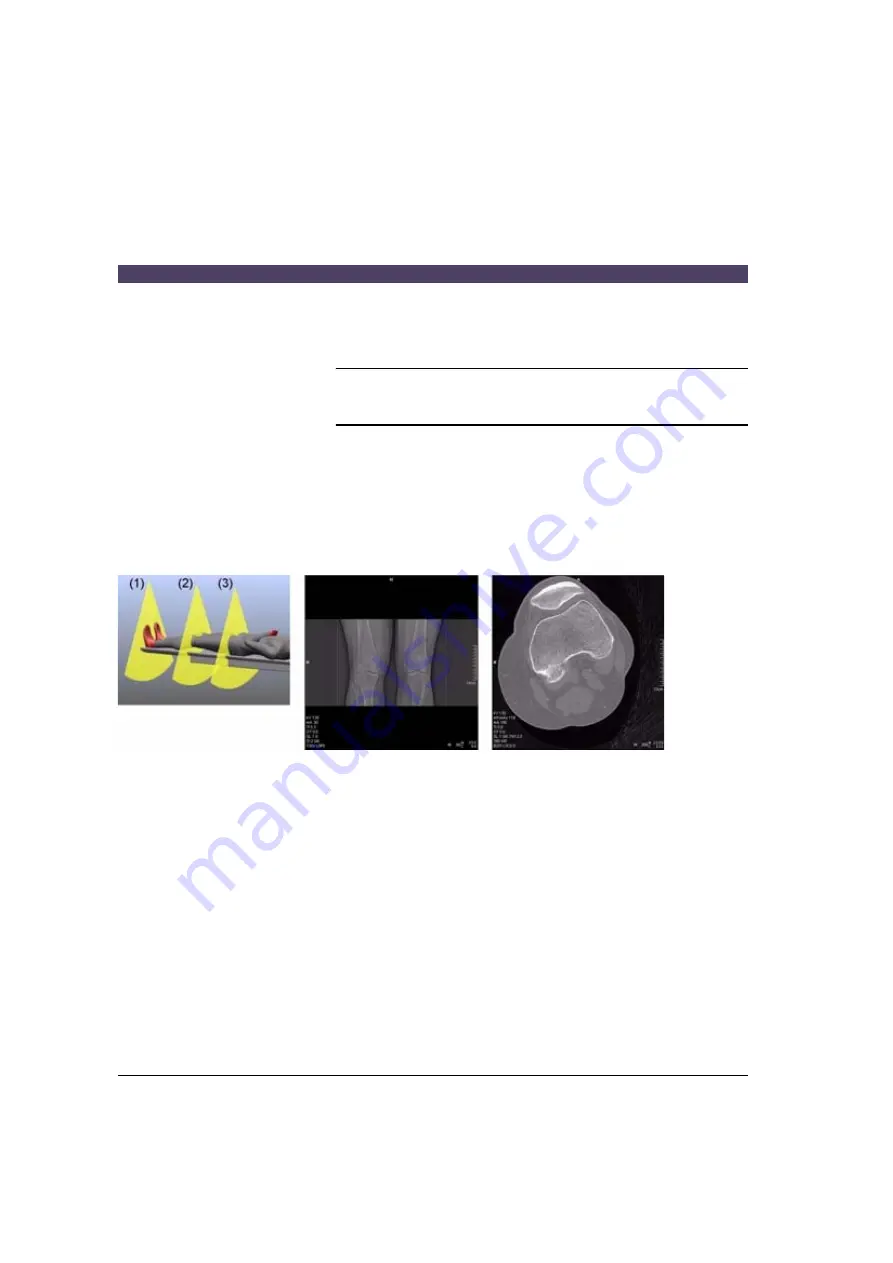 Siemens SOMATOM Emotion syngo CT 2007E Operator'S Manual Download Page 378