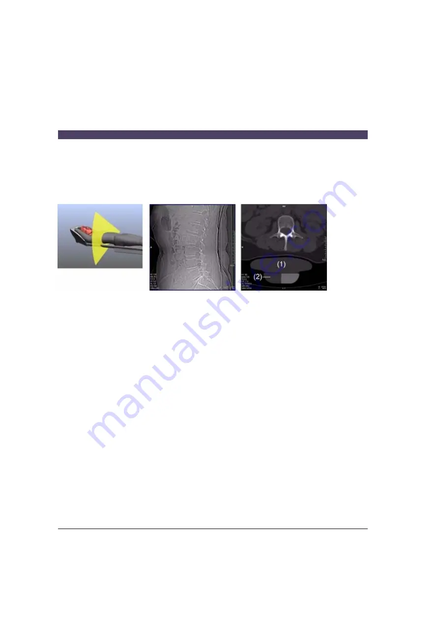 Siemens SOMATOM Emotion syngo CT 2007E Operator'S Manual Download Page 382