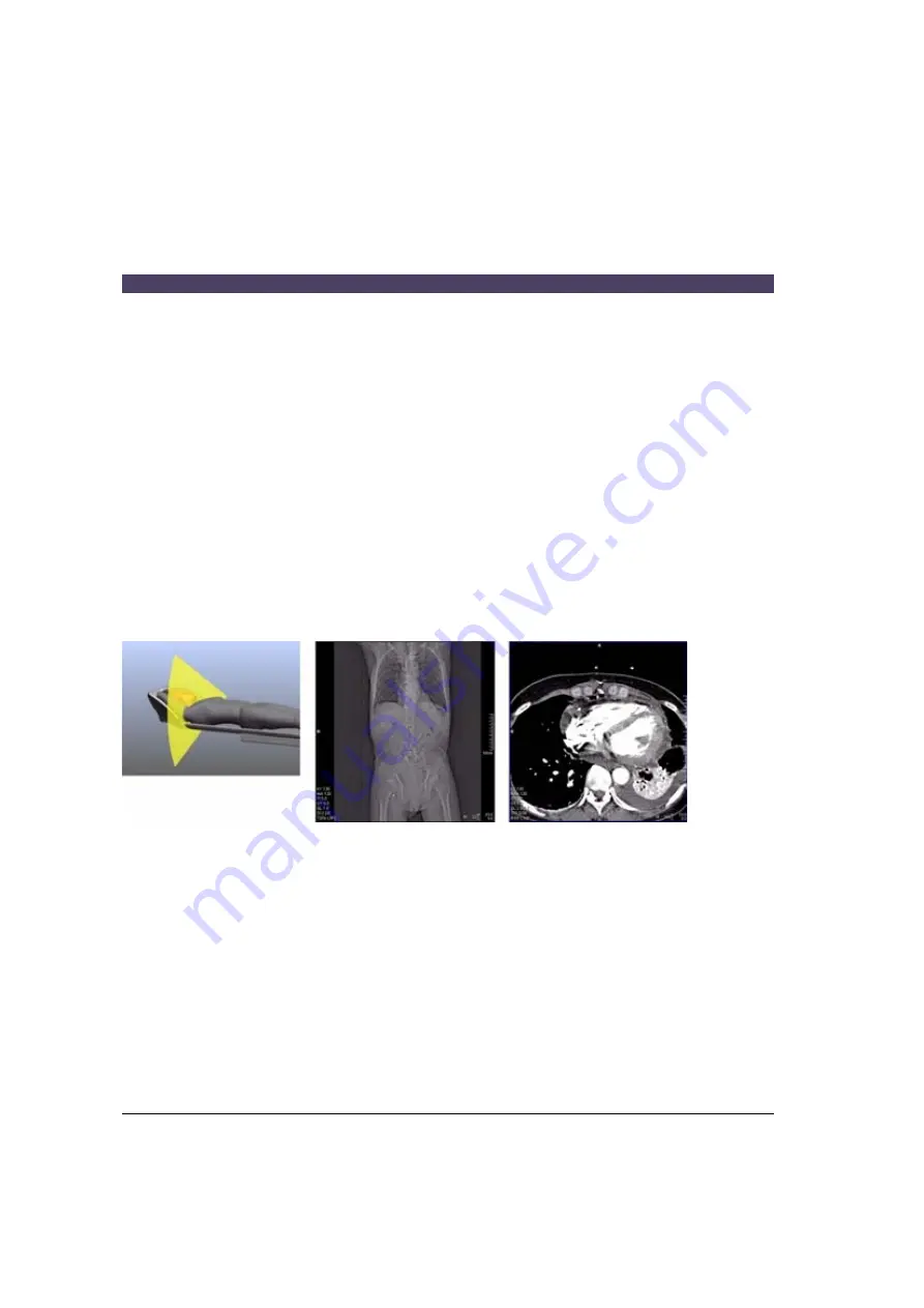 Siemens SOMATOM Emotion syngo CT 2007E Operator'S Manual Download Page 384