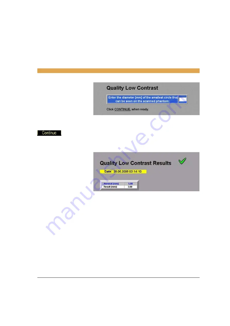 Siemens SOMATOM Emotion syngo CT 2007E Operator'S Manual Download Page 513