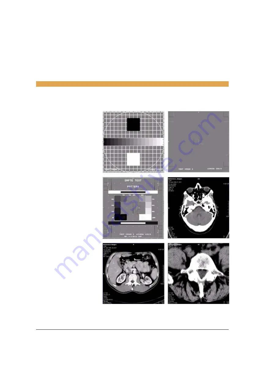 Siemens SOMATOM Emotion syngo CT 2007E Operator'S Manual Download Page 524