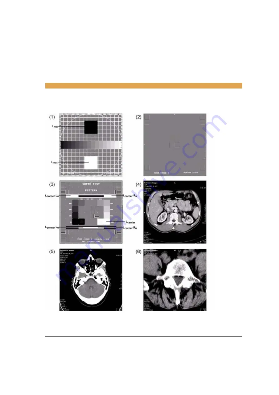 Siemens SOMATOM Emotion syngo CT 2007E Operator'S Manual Download Page 531