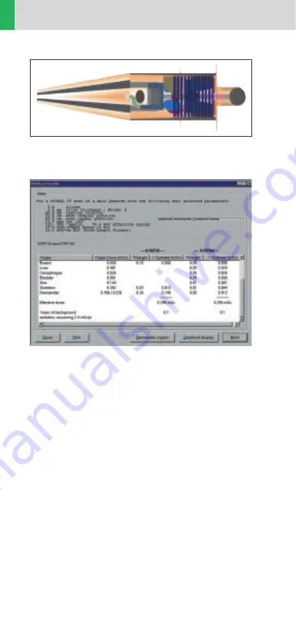 Siemens SOMATOM Sensation 16 Application Manual Download Page 16