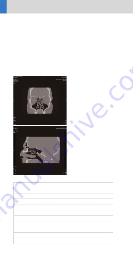 Siemens SOMATOM Sensation 16 Application Manual Download Page 36