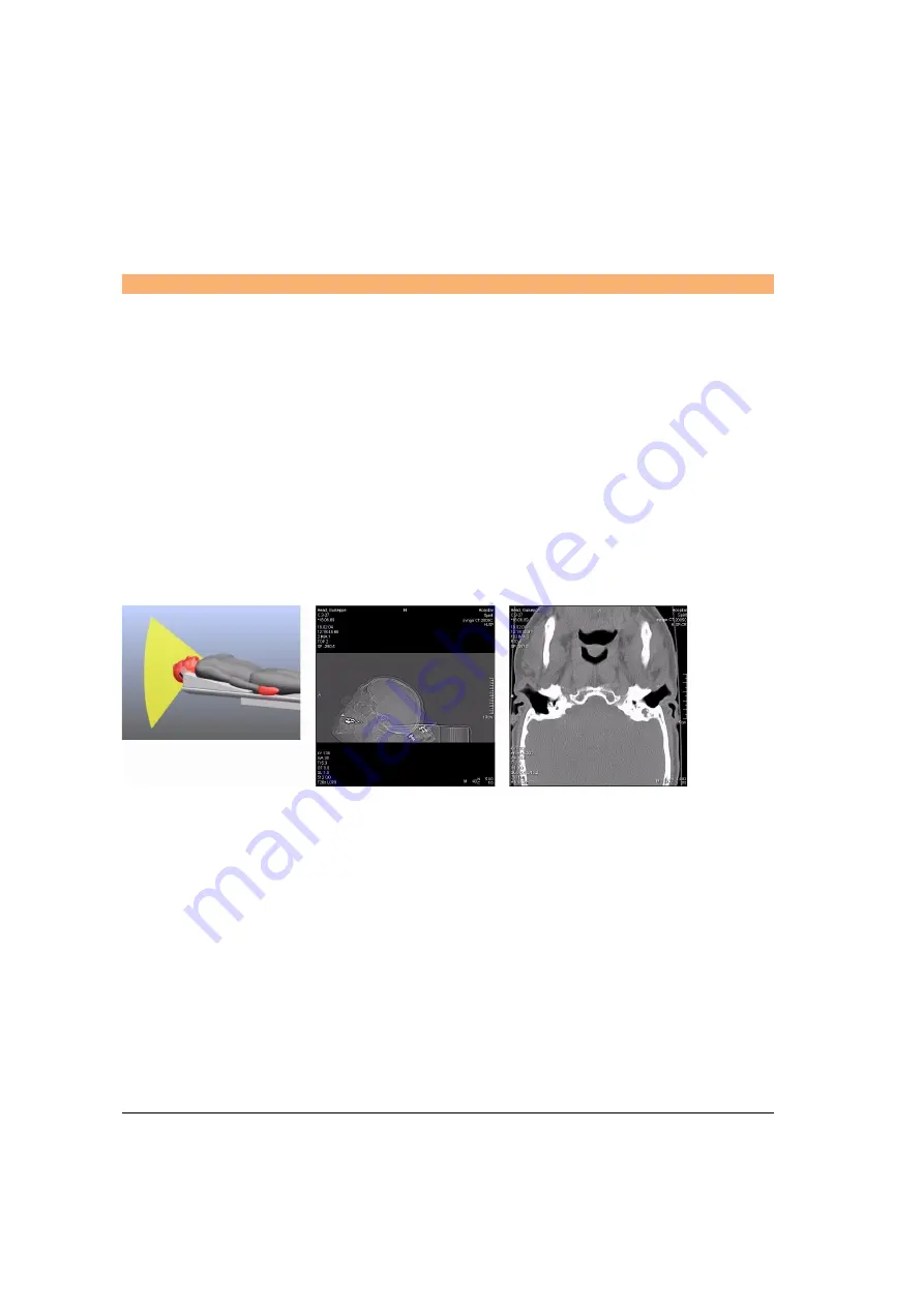 Siemens SOMATOM Spirit Operator'S Manual Download Page 326