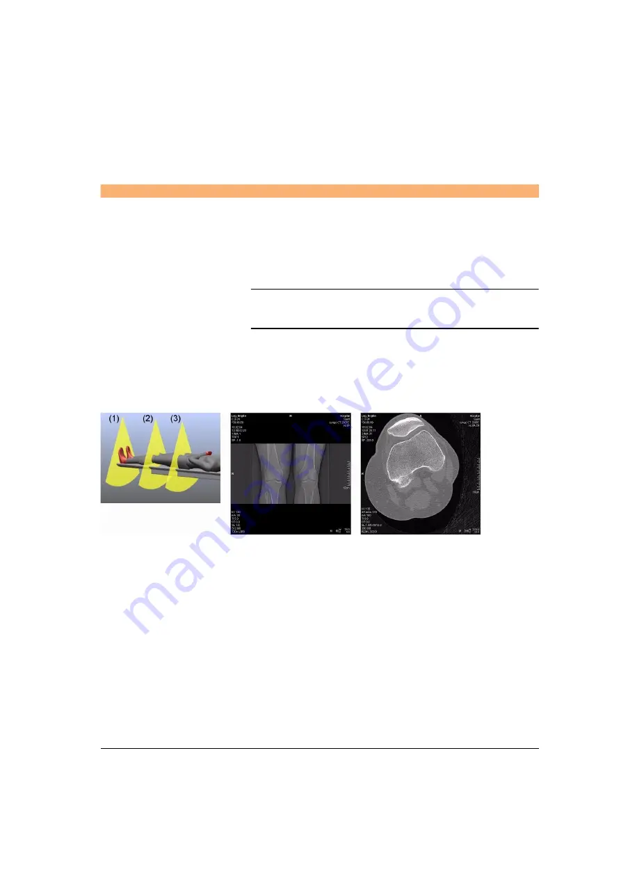 Siemens SOMATOM Spirit Operator'S Manual Download Page 339