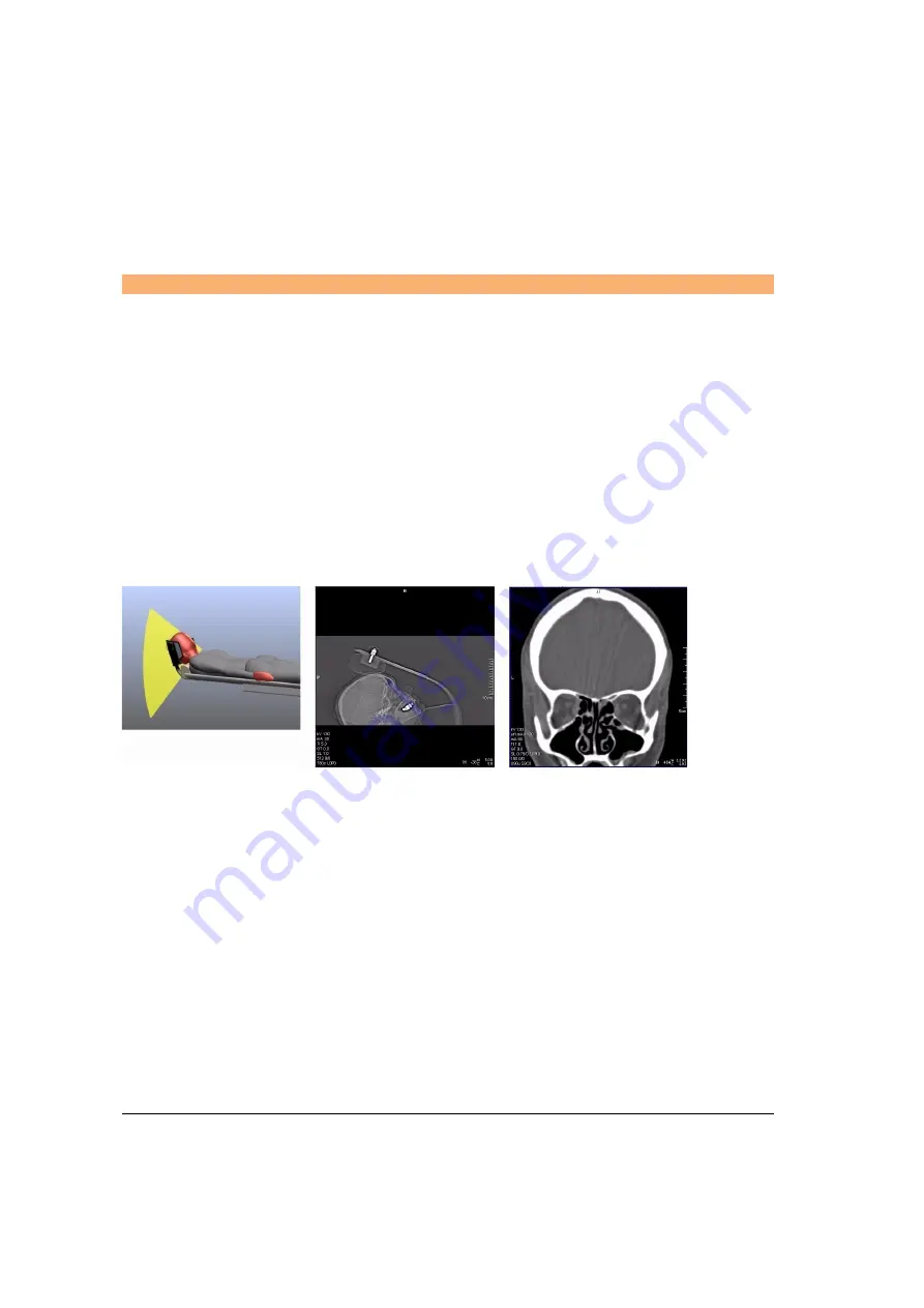 Siemens SOMATOM Spirit Operator'S Manual Download Page 342