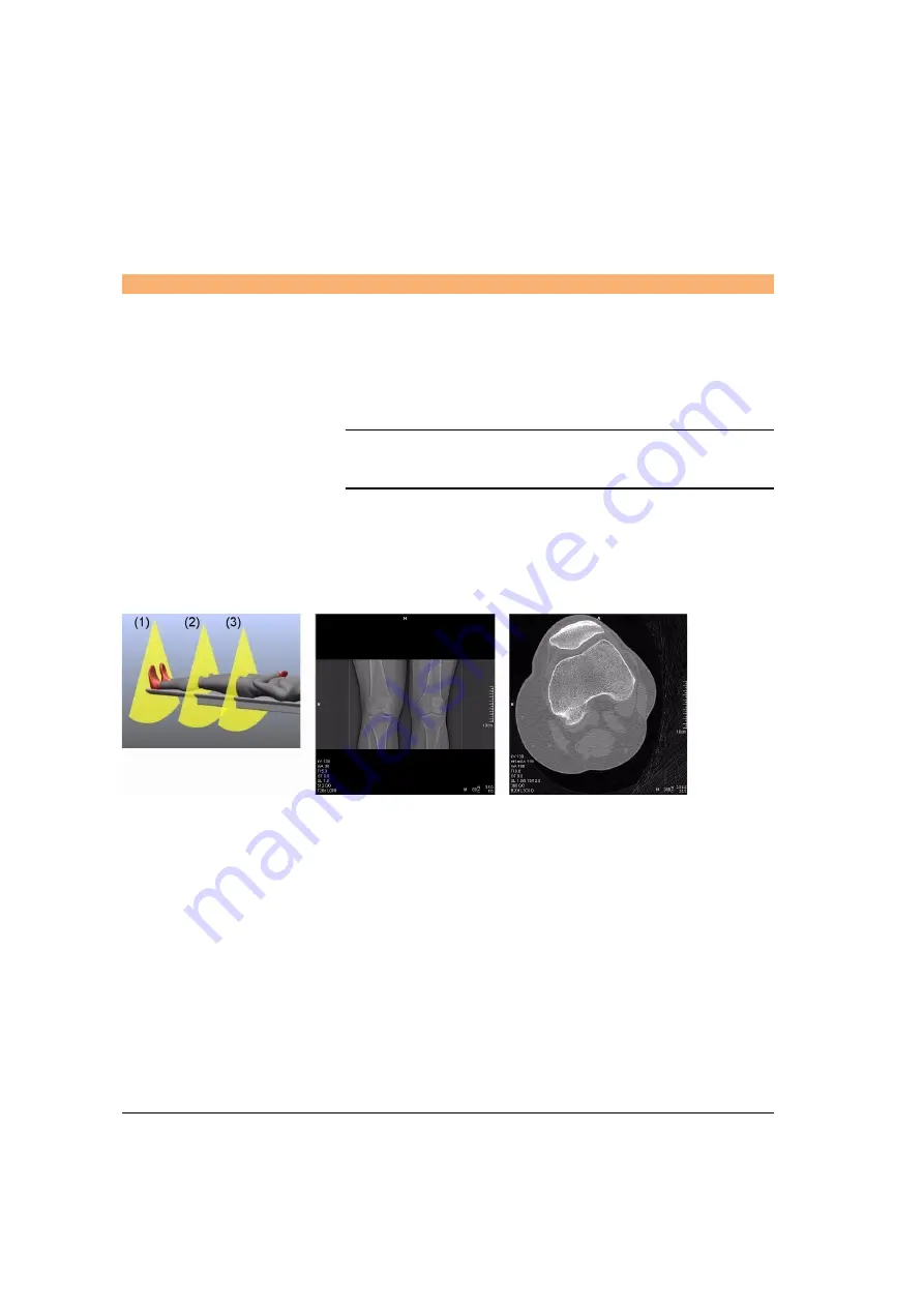 Siemens SOMATOM Spirit Operator'S Manual Download Page 344