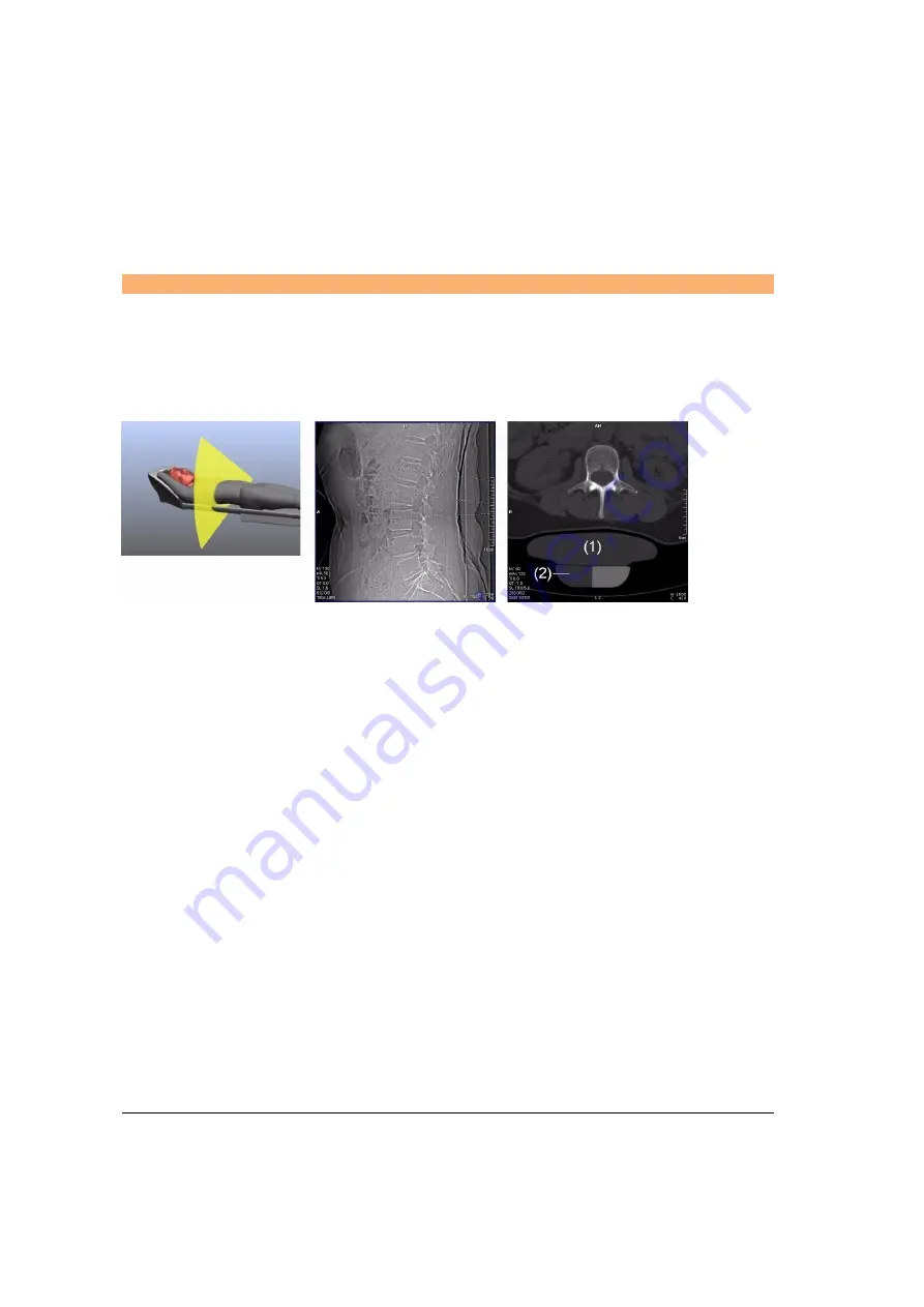 Siemens SOMATOM Spirit Operator'S Manual Download Page 348