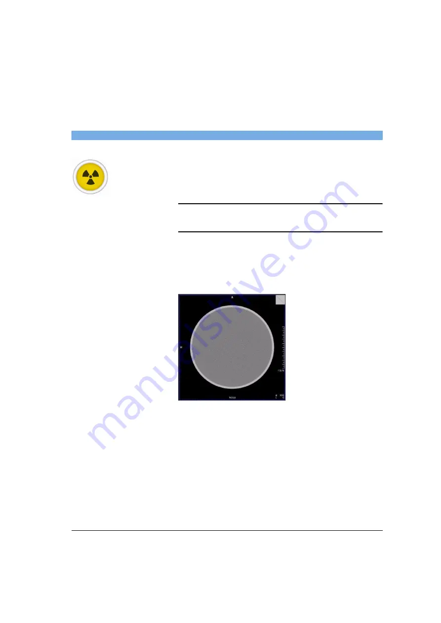 Siemens SOMATOM Spirit Operator'S Manual Download Page 381