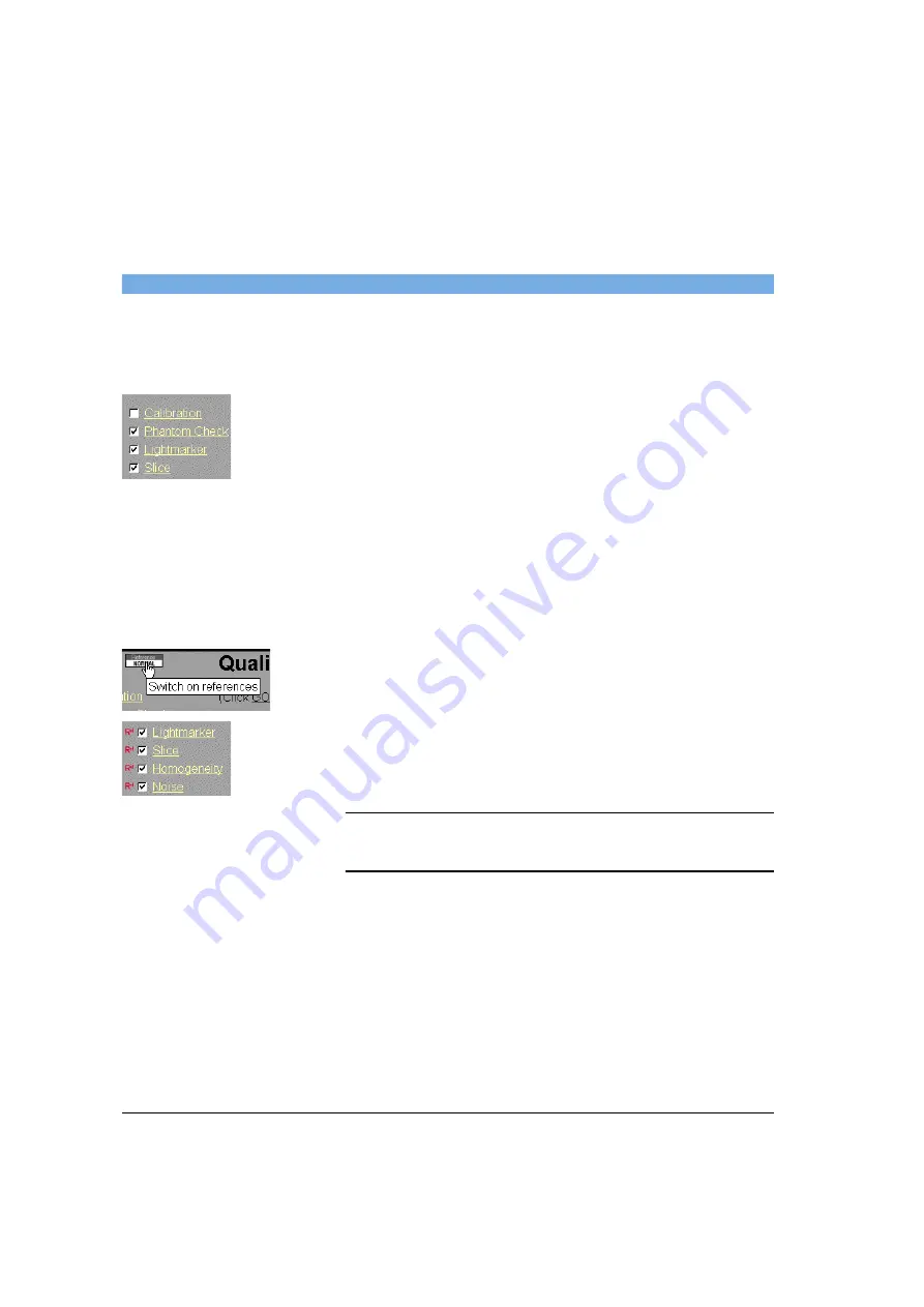 Siemens SOMATOM Spirit Operator'S Manual Download Page 388