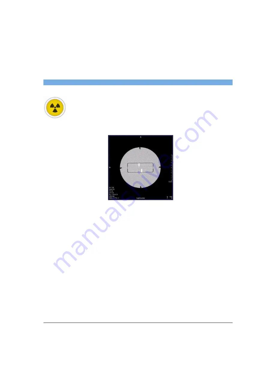 Siemens SOMATOM Spirit Operator'S Manual Download Page 393