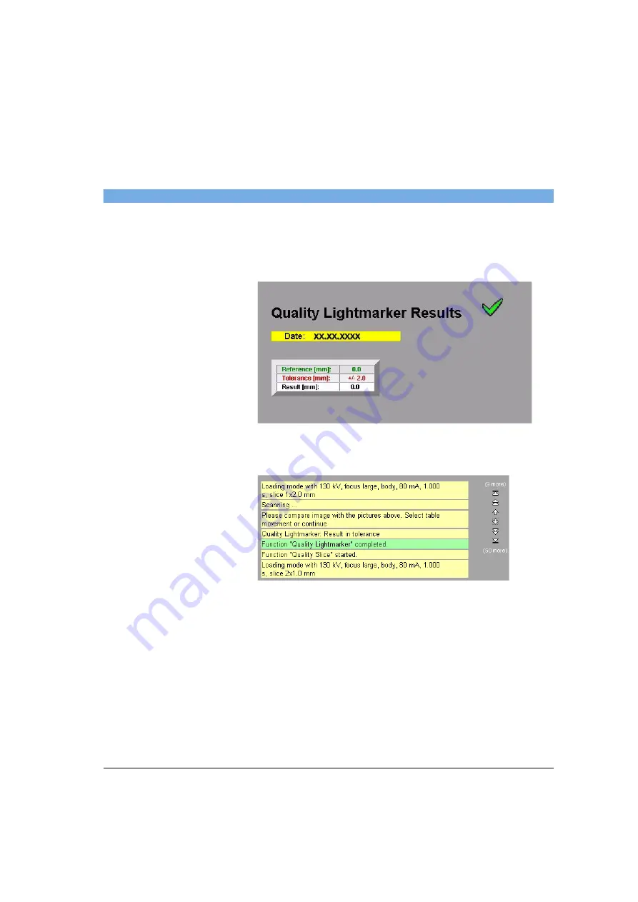 Siemens SOMATOM Spirit Operator'S Manual Download Page 395