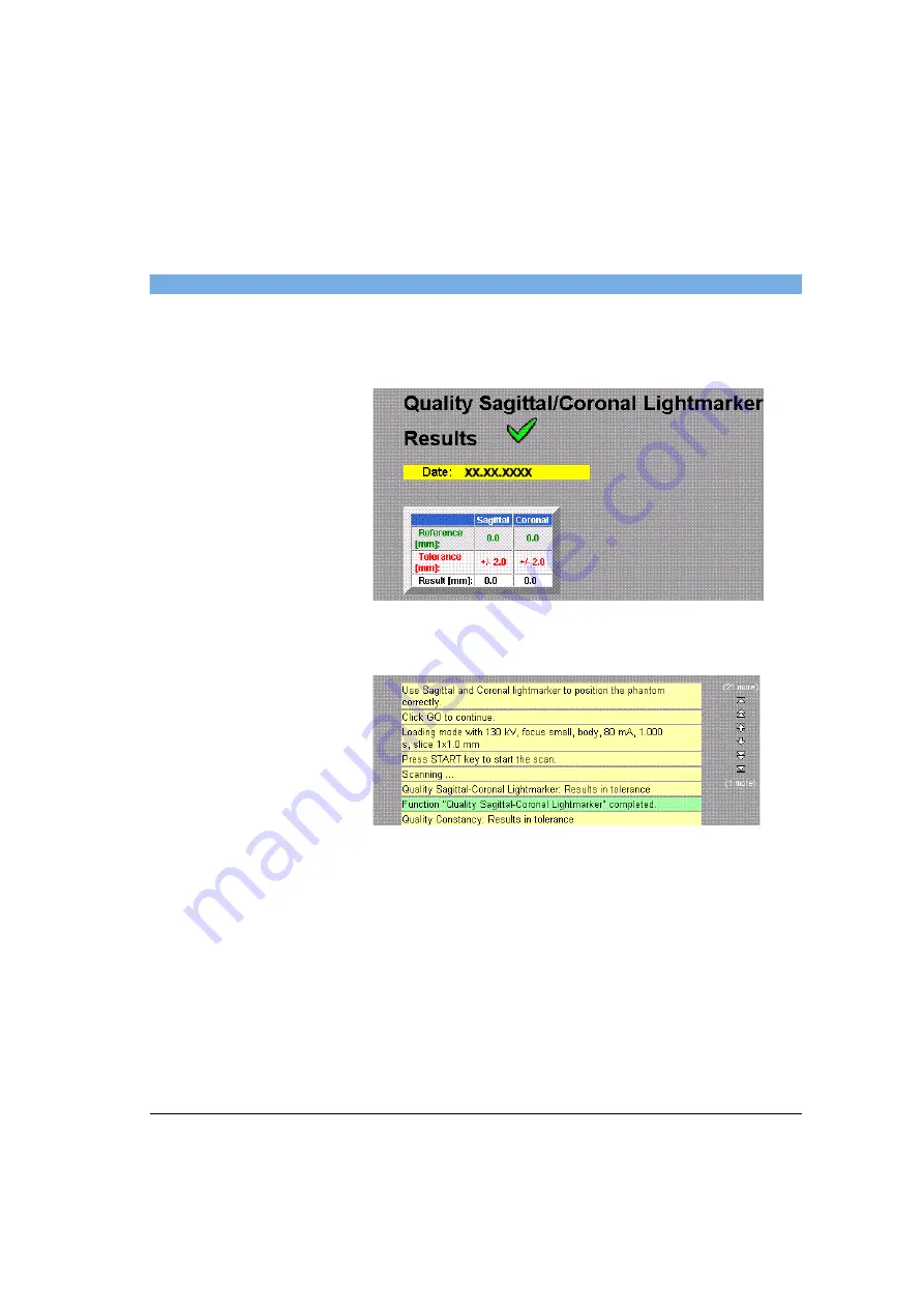 Siemens SOMATOM Spirit Operator'S Manual Download Page 397