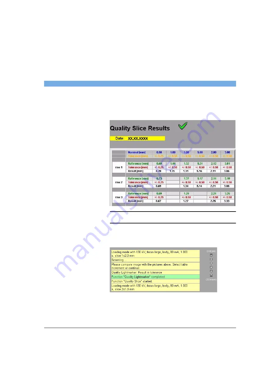 Siemens SOMATOM Spirit Operator'S Manual Download Page 403