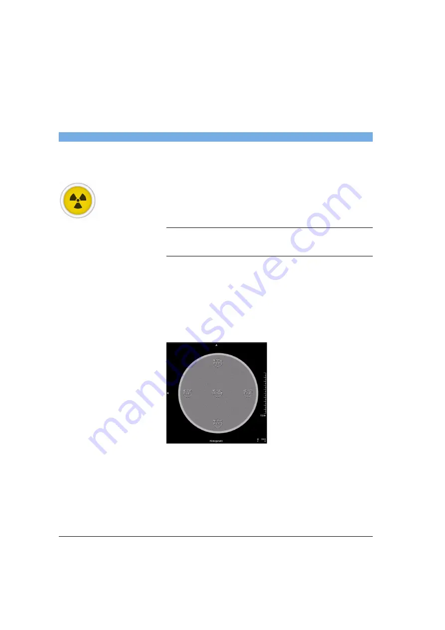 Siemens SOMATOM Spirit Operator'S Manual Download Page 404