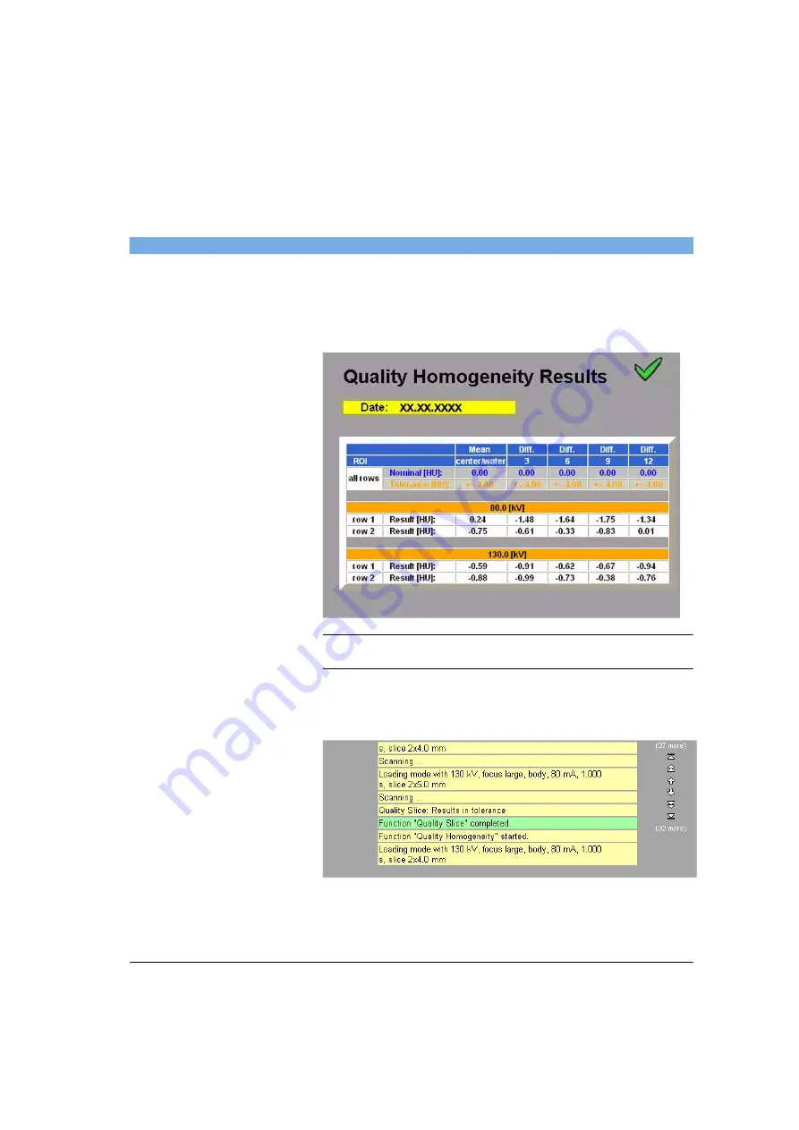 Siemens SOMATOM Spirit Operator'S Manual Download Page 405