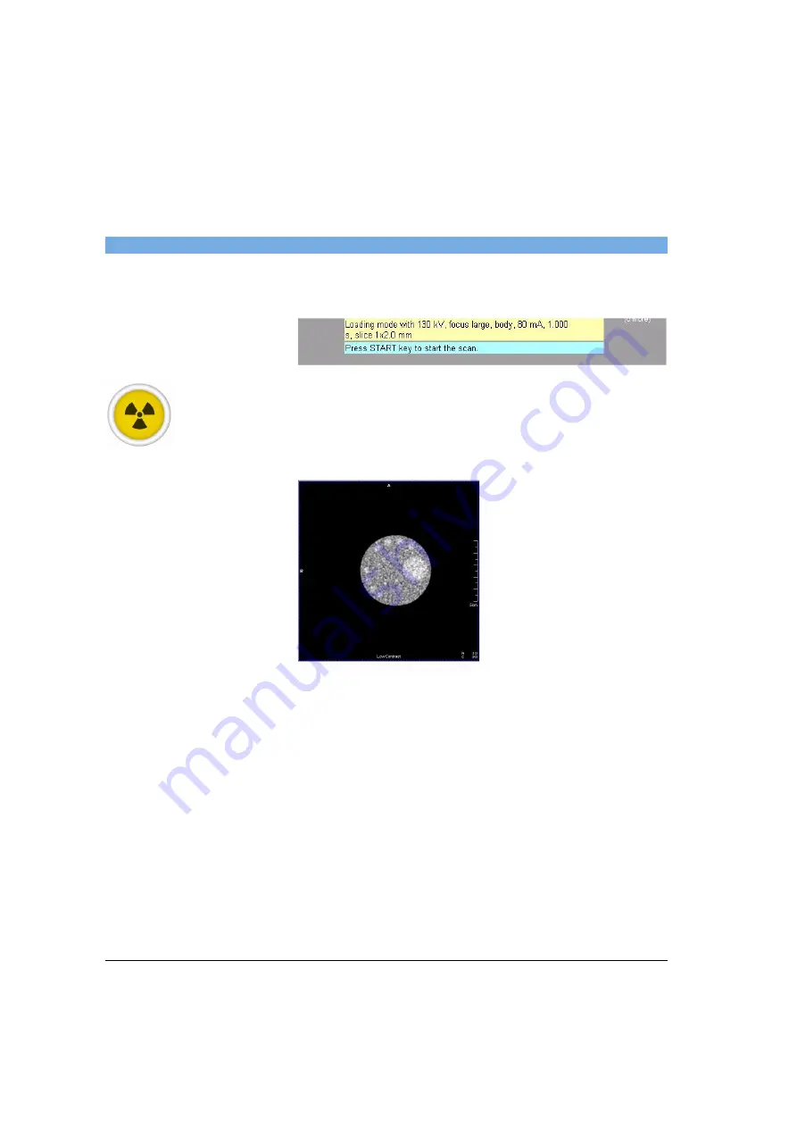 Siemens SOMATOM Spirit Operator'S Manual Download Page 428