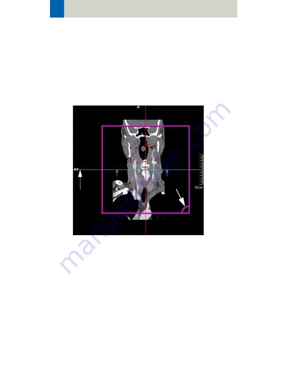 Siemens SOMATOM Manual Download Page 68