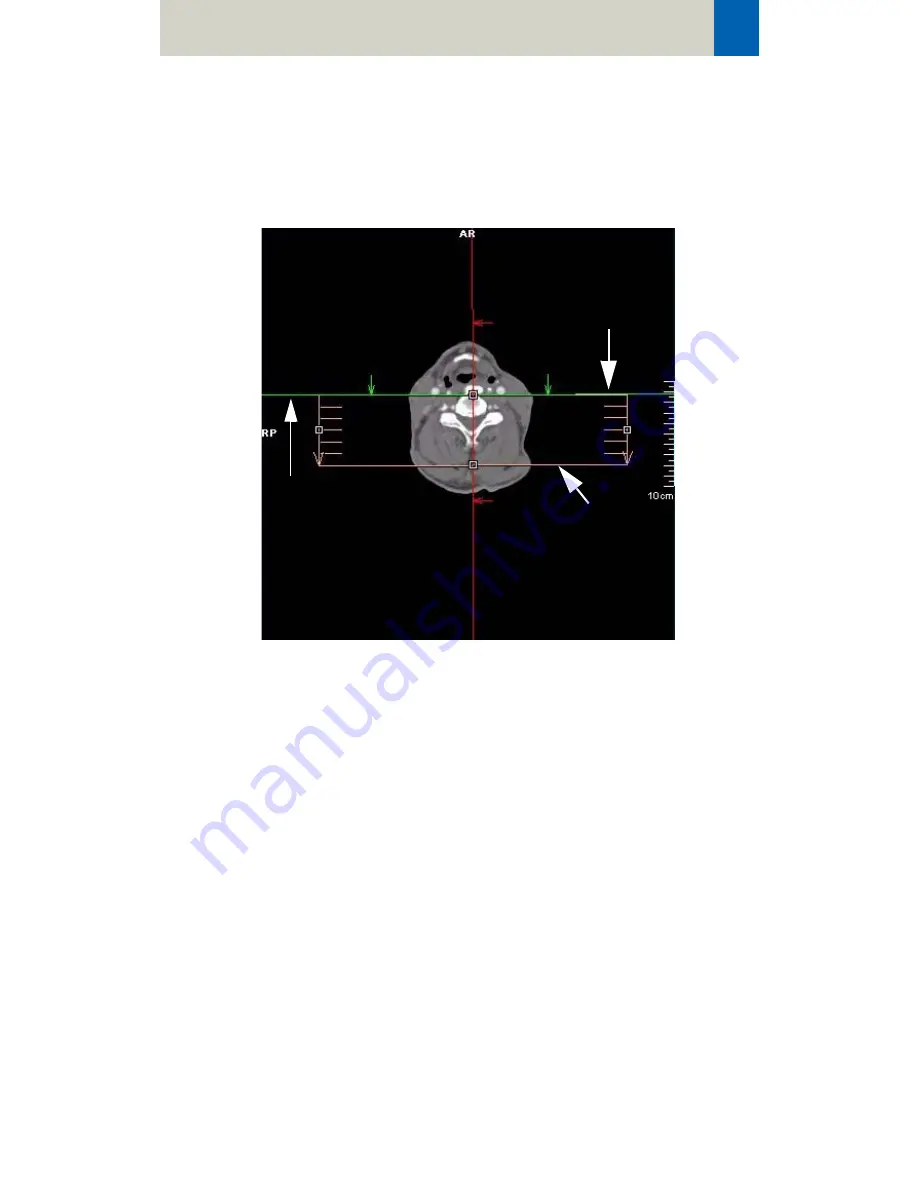 Siemens SOMATOM Manual Download Page 69