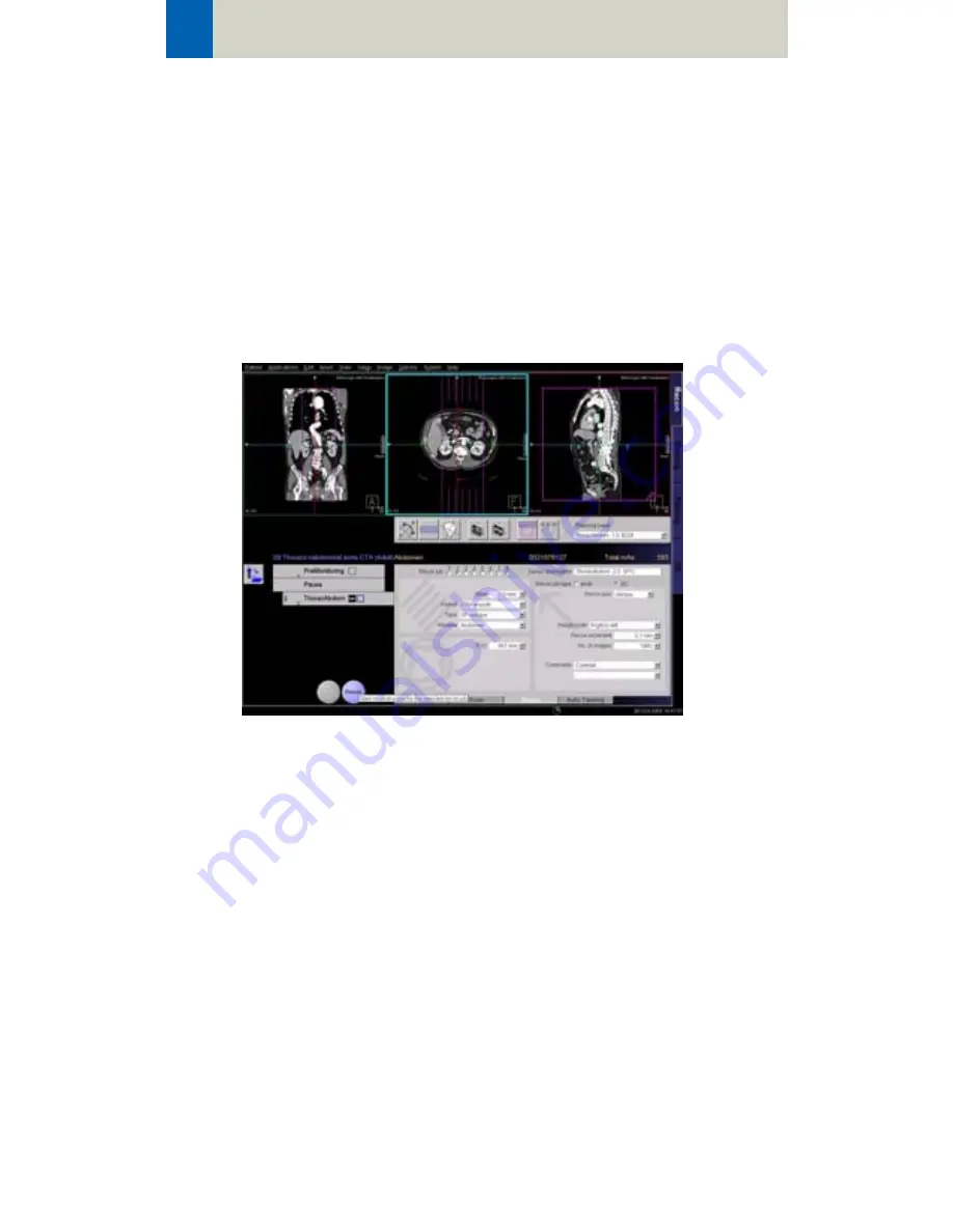 Siemens SOMATOM Manual Download Page 92