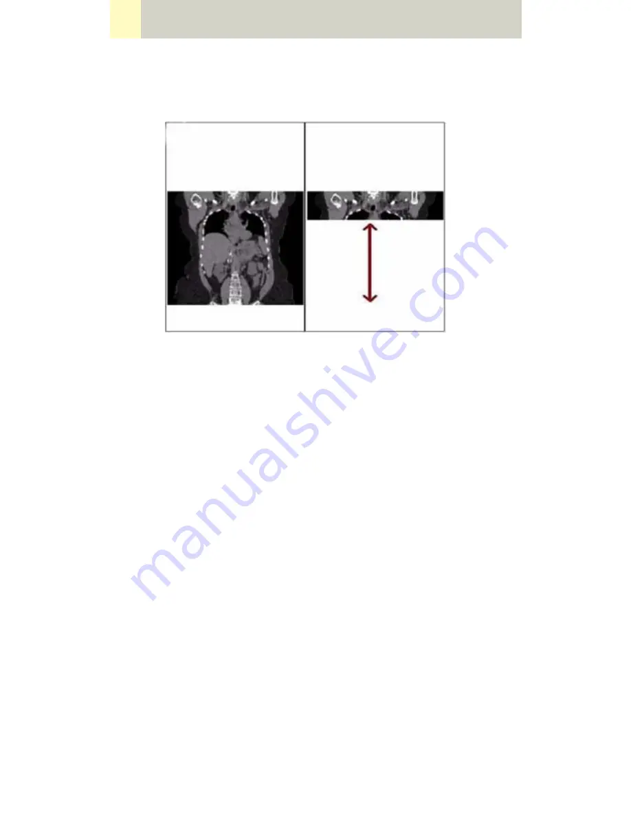 Siemens SOMATOM Manual Download Page 466