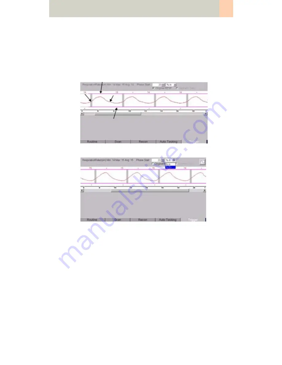 Siemens SOMATOM Manual Download Page 493