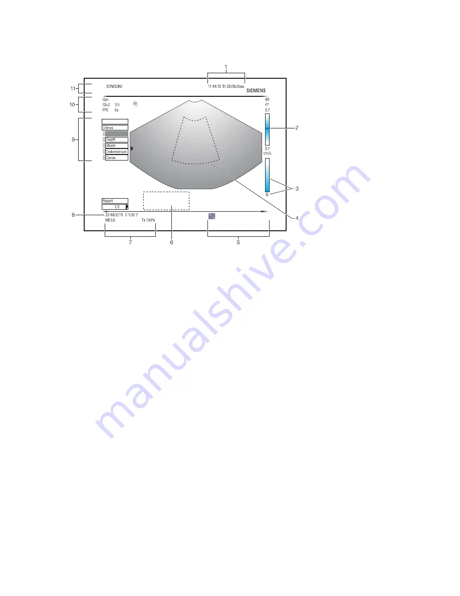 Siemens SONOLINE G50 Instructions For Use Manual Download Page 15