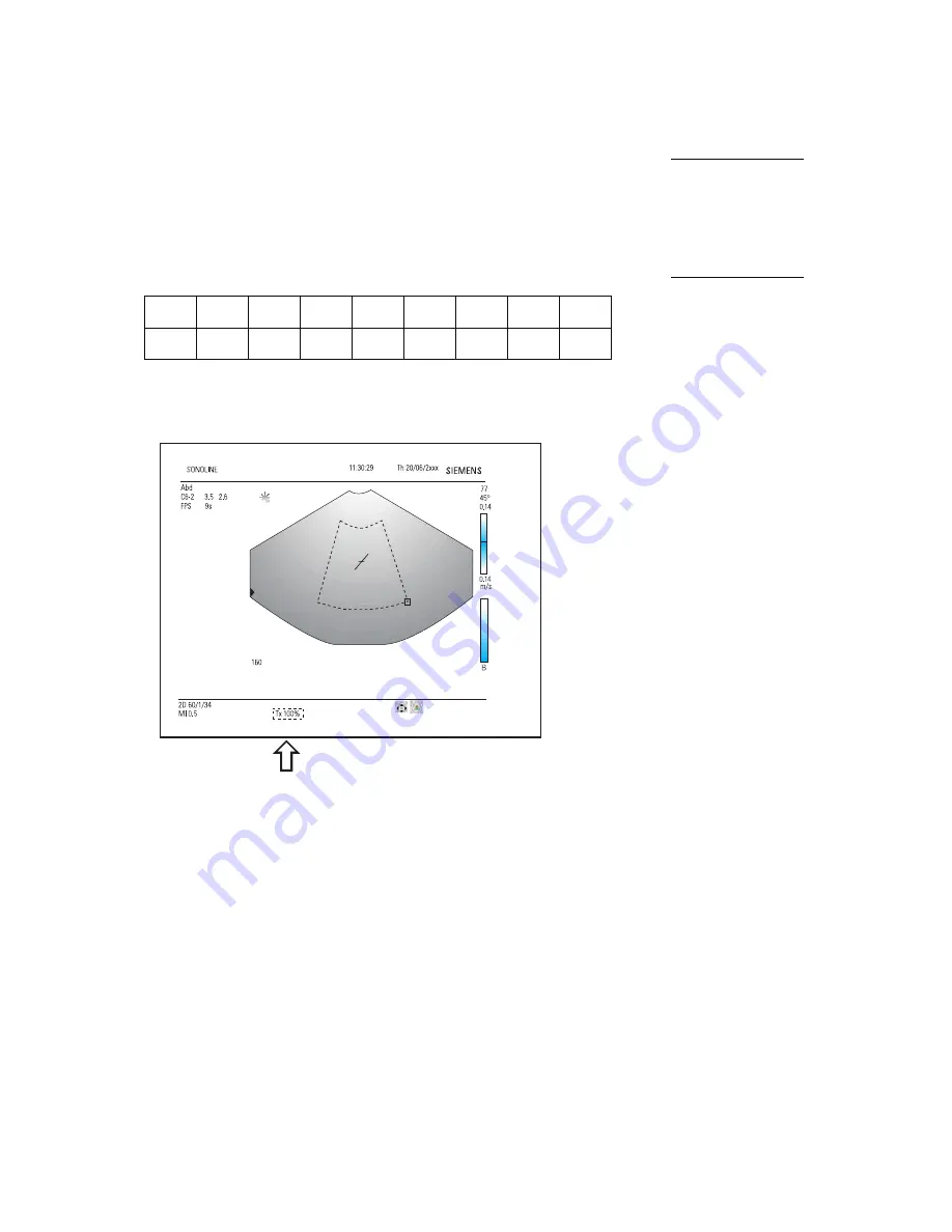 Siemens SONOLINE G50 Instructions For Use Manual Download Page 30