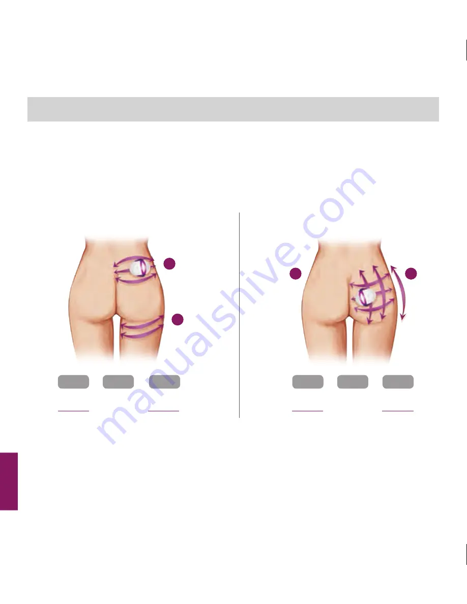 Silk'n SILH1PE1001 Instructions For Use Manual Download Page 107