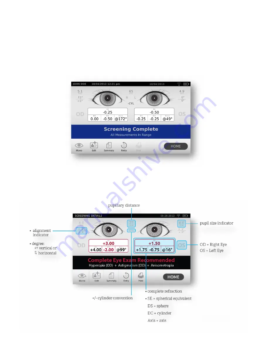 SPOT VS100 Vision Screening Device Instructions For Use Manual Download Page 12