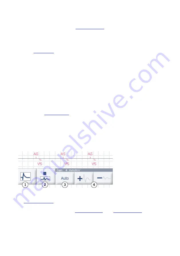 St. Jude Medical Merlin PSA EX3100 Скачать руководство пользователя страница 19