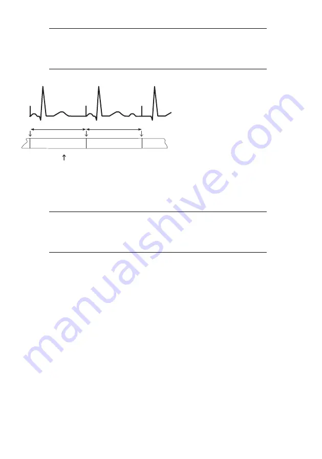 St. Jude Medical Merlin PSA EX3100 Скачать руководство пользователя страница 44