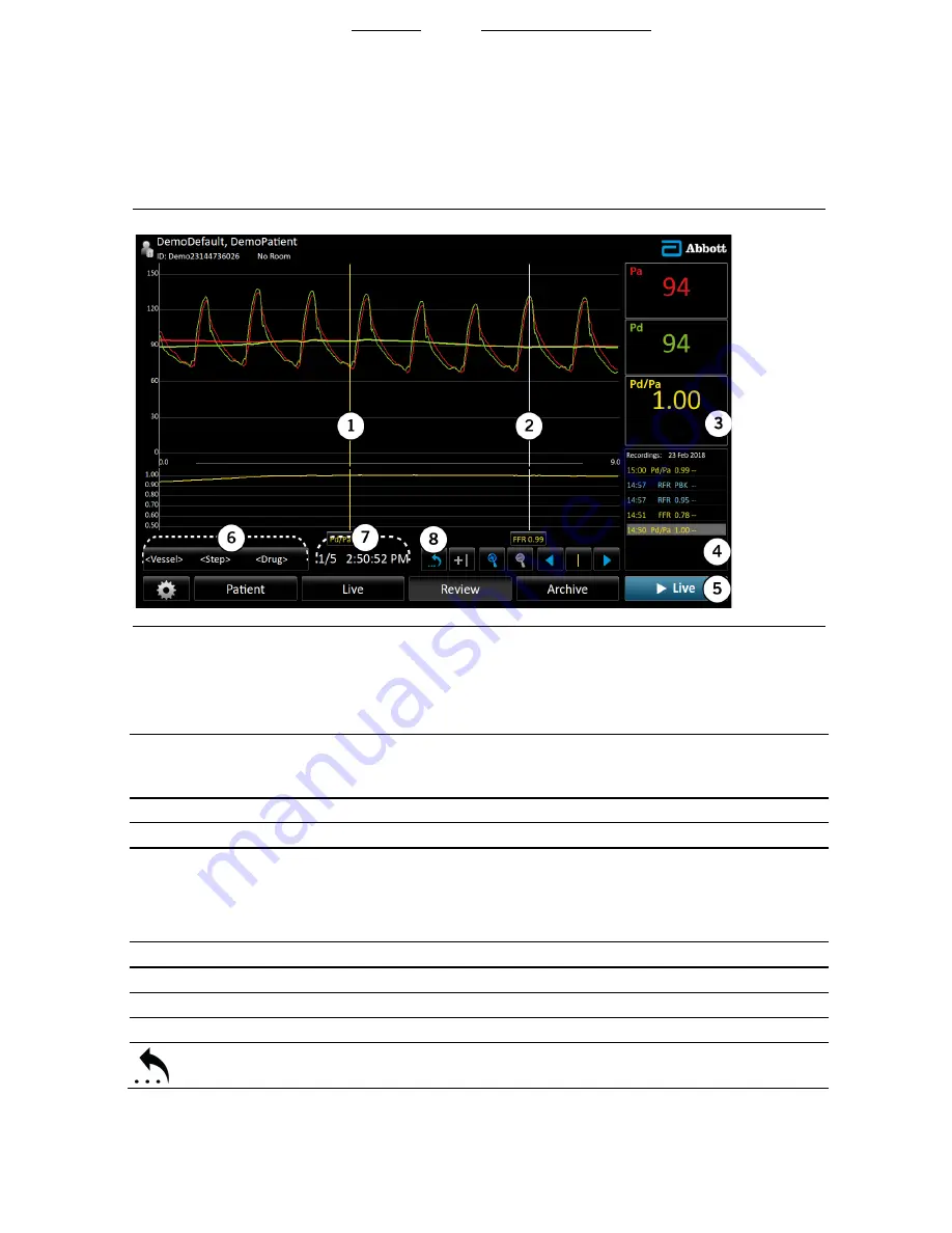 St. Jude Medical QUANTIEN Скачать руководство пользователя страница 29