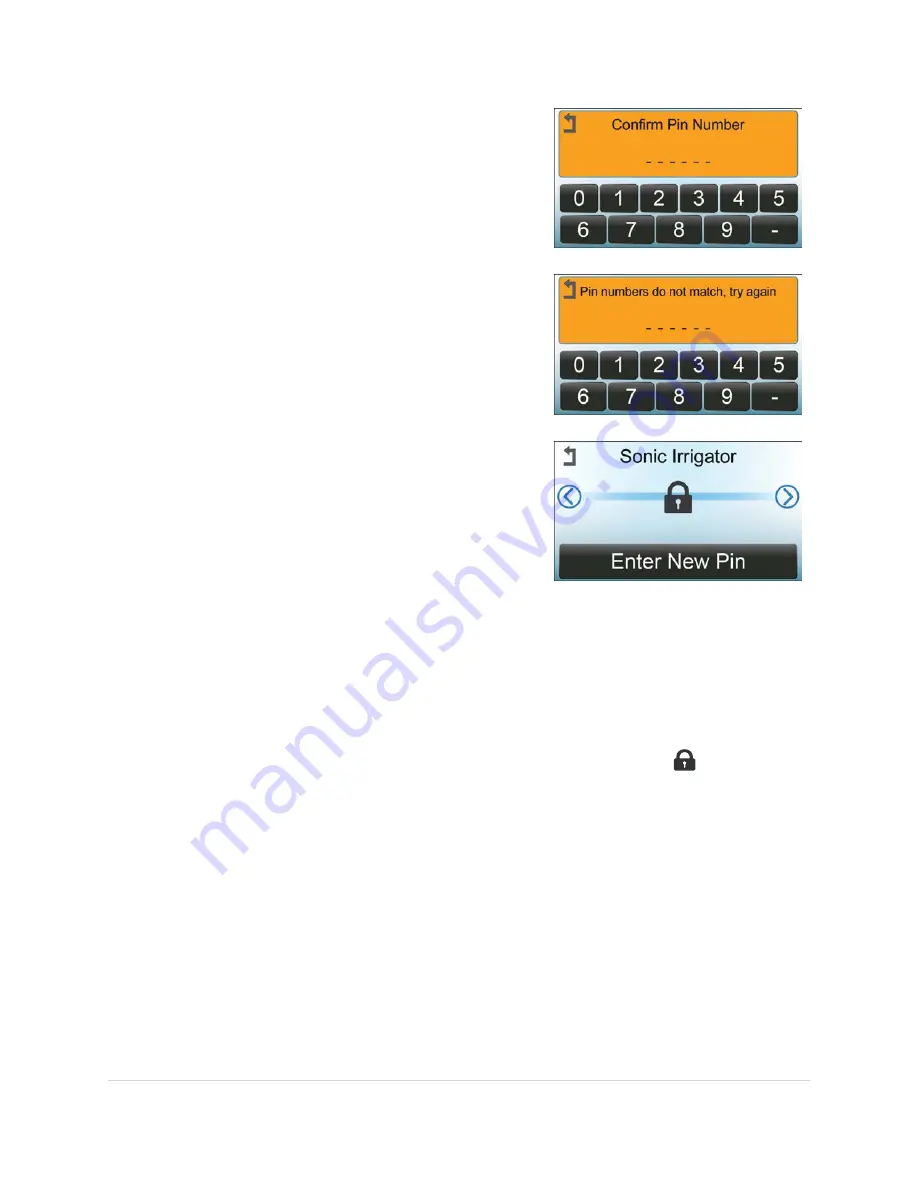 Steris InnoWave PCF Sonic Irrigator Operator'S Manual Download Page 102