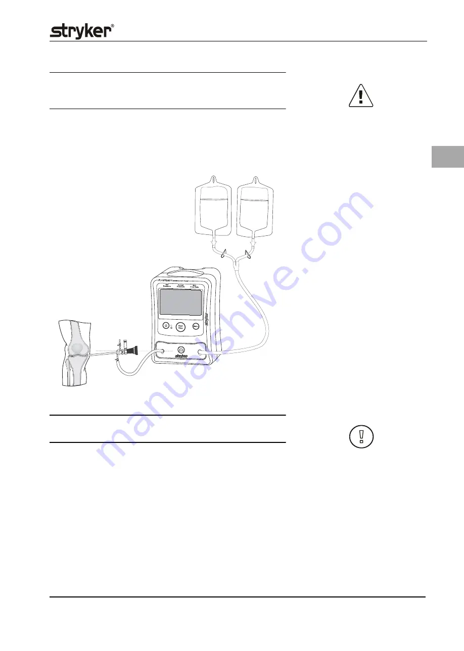 Stryker Flosteady Arthroscopy Pump 200 Скачать руководство пользователя страница 141